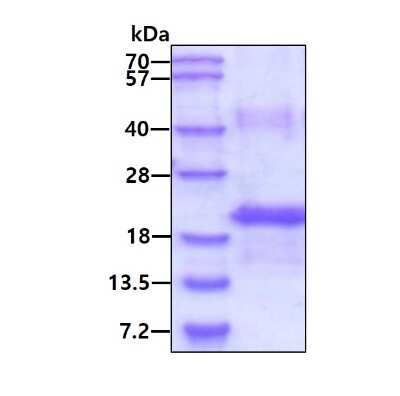 SDS-Page: Recombinant Human M-CSF His Protein [NBP1-30174] - 3ug by SDS-PAGE under reducing condition and visualized by coomassie blue stain